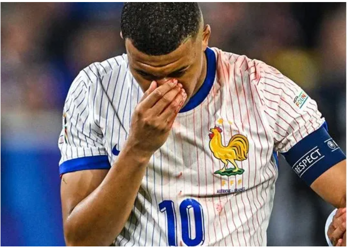 Kylian Mbappé Oo Dhaawac Soo Gaadhay Kulankii Xulkiisa.